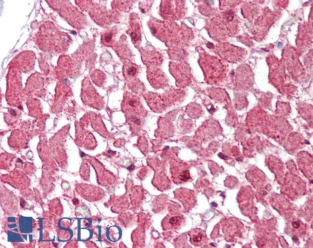 IHC-plus™ Polyclonal Rabbit anti-Human CASP12 / Caspase 12 Antibody (IHC, IF, WB)