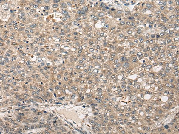 FUT4 / CD15 Antibody