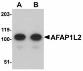 IHC-plus™ AFAP1L2 / XB130 Antibody