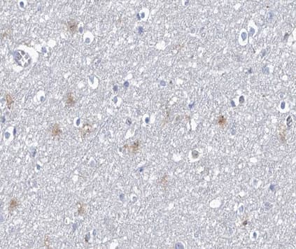 Polyclonal Rabbit anti-Human PPP1R14A / CPI-17 Antibody (phospho-Thr38, IHC, IF, WB)