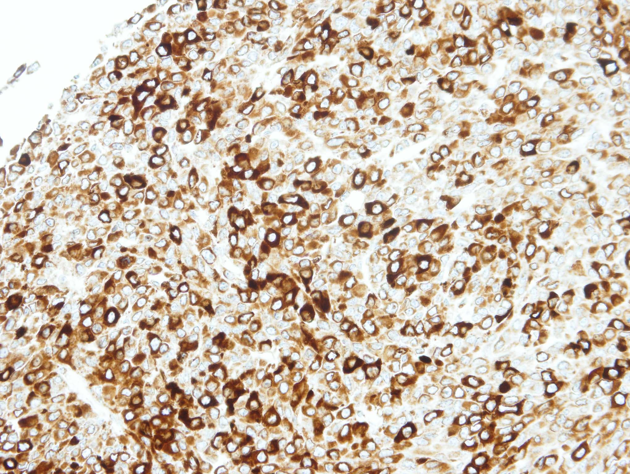 STAP2 Antibody (aa340-403)