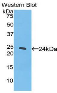 PPARG / PPAR Gamma Antibody (aa311-500)