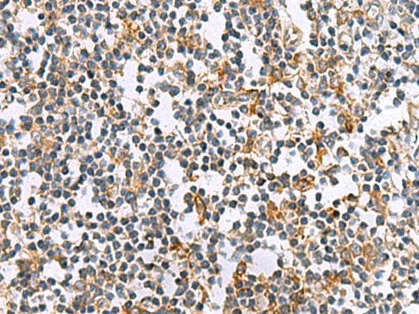 GCAP / GUCA1A Antibody