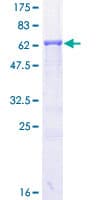 Human PRKACA Protein (Recombinant GST)