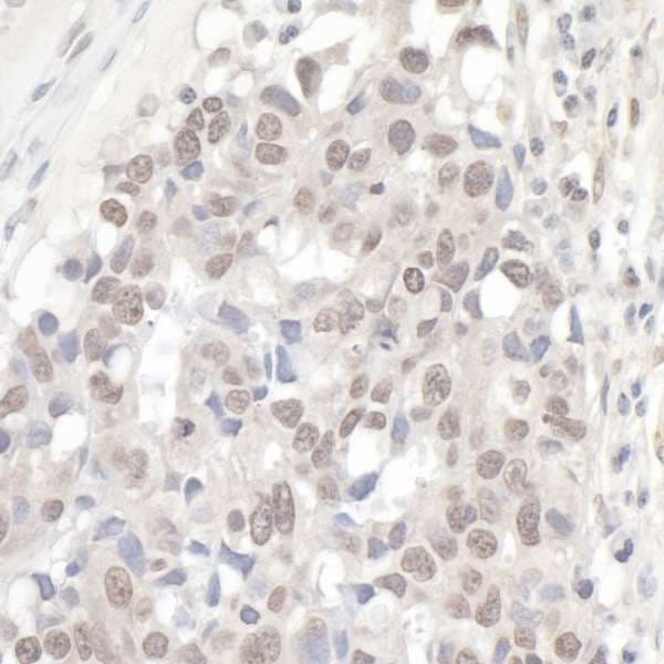 NCBP1 / CBP80 Antibody (aa482-532)