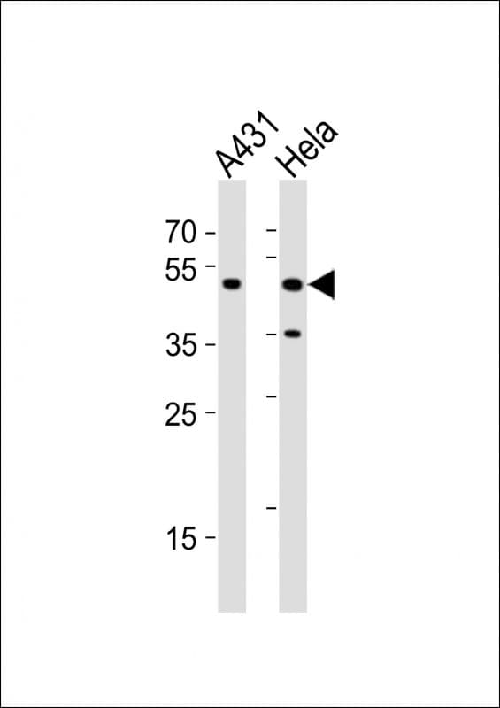 CYP24 / CYP24A1 Antibody (aa480-514)
