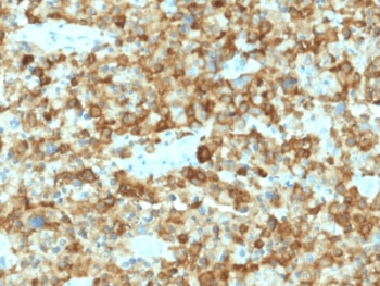 Monoclonal Mouse anti-Human PMEL / SILV / gp100 Antibody (clone PMEL/2037, IHC)