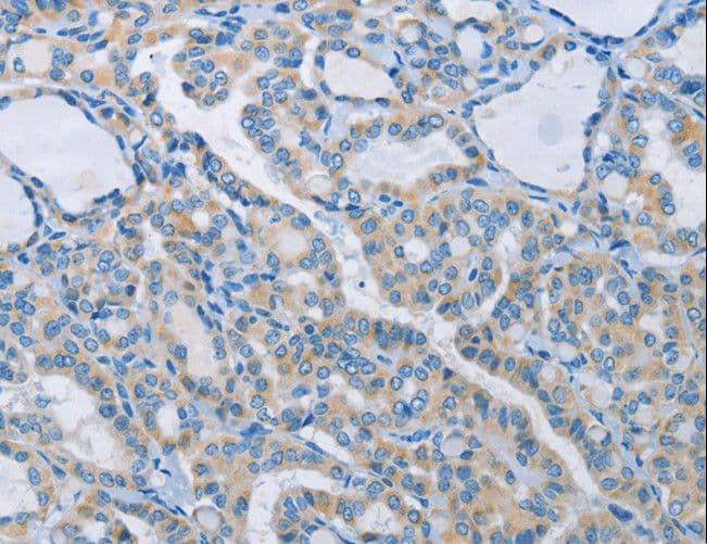 NEK5 Antibody