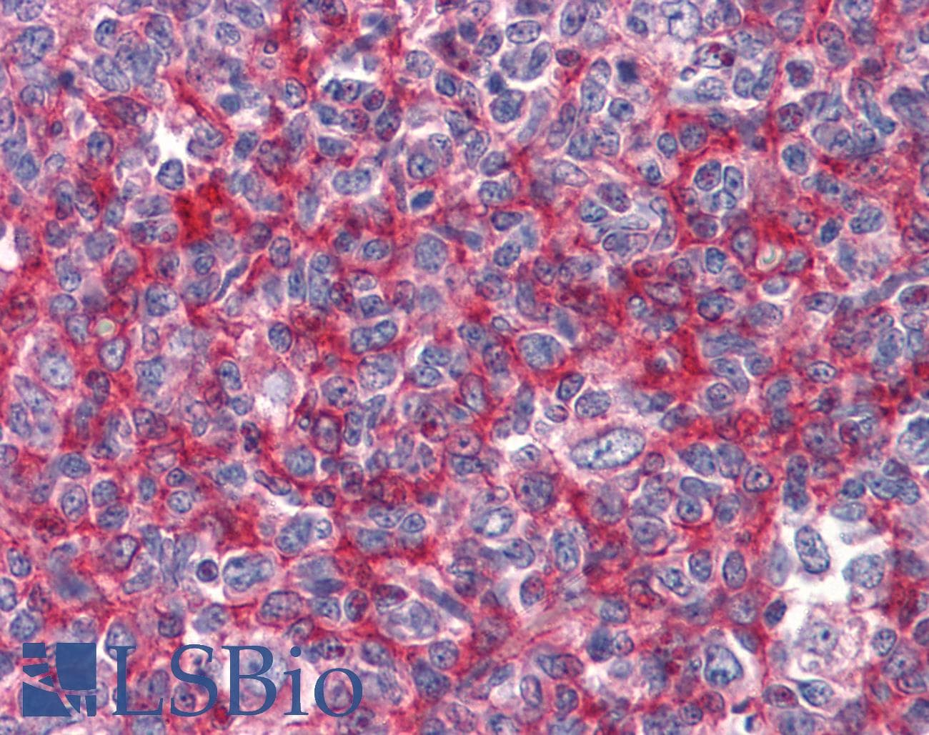 IHC-plus™ GBP1 Antibody (clone 4D10)
