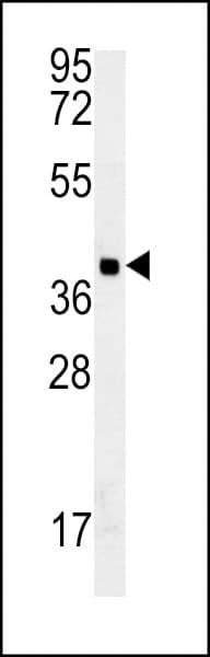 Polyclonal Rabbit anti-Human GDPD3 Antibody (aa17-46, IHC, WB)