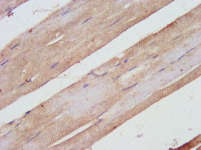 Polyclonal Rabbit anti-Human SHARPIN Antibody (IHC, IF, WB)