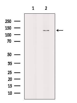 Polyclonal Rabbit anti-Human AFAP1L2 / XB130 Antibody (IF, WB)