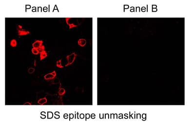 CA9 / Carbonic Anhydrase IX Antibody (C-Terminus, DY488)