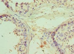 IHC-plus™ Polyclonal Rabbit anti-Human RNF8 Antibody (aa1-260, IHC, WB)