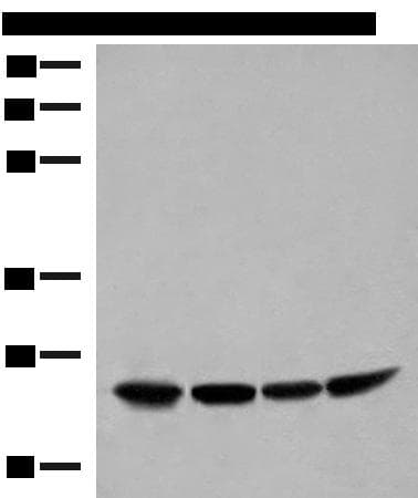 Thymidylate Kinase Antibody