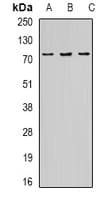 OPTN / Optineurin Antibody