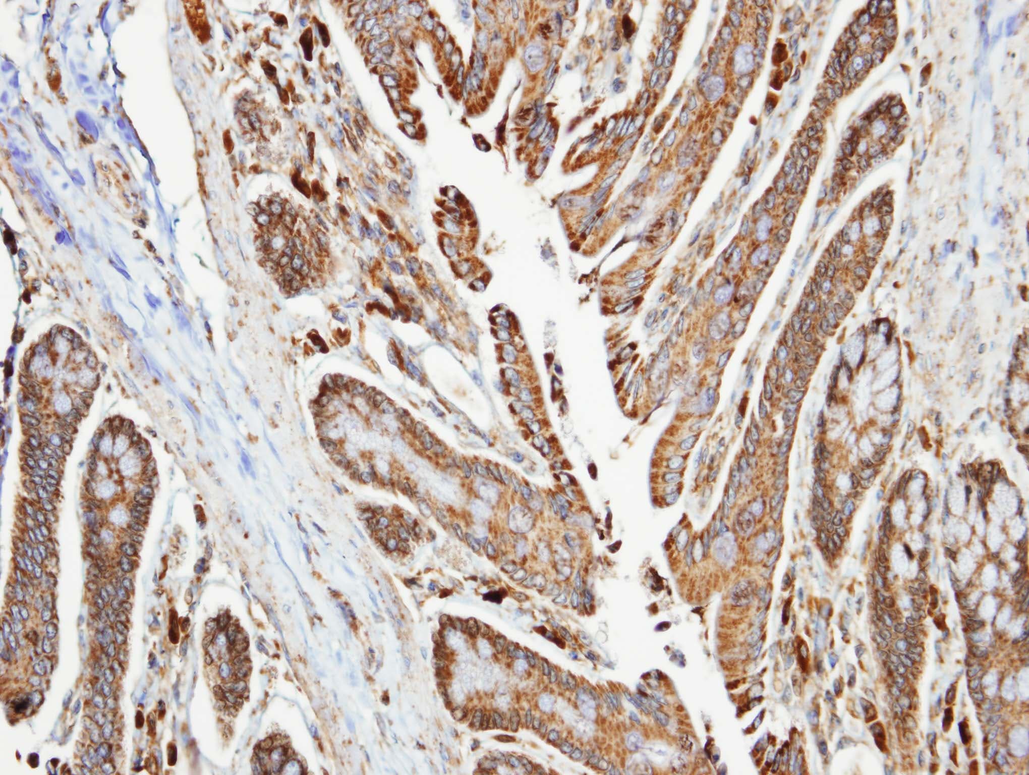 Polyclonal Rabbit anti-Human NDUFA10 Antibody (aa43-355, IHC, WB)