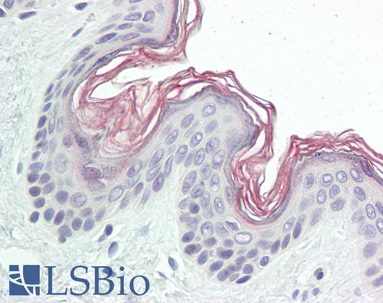 IHC-plus™ PPHLN1 Antibody (aa71-120)