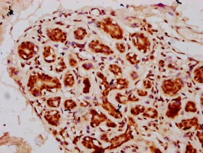 HIST1H2BN Antibody