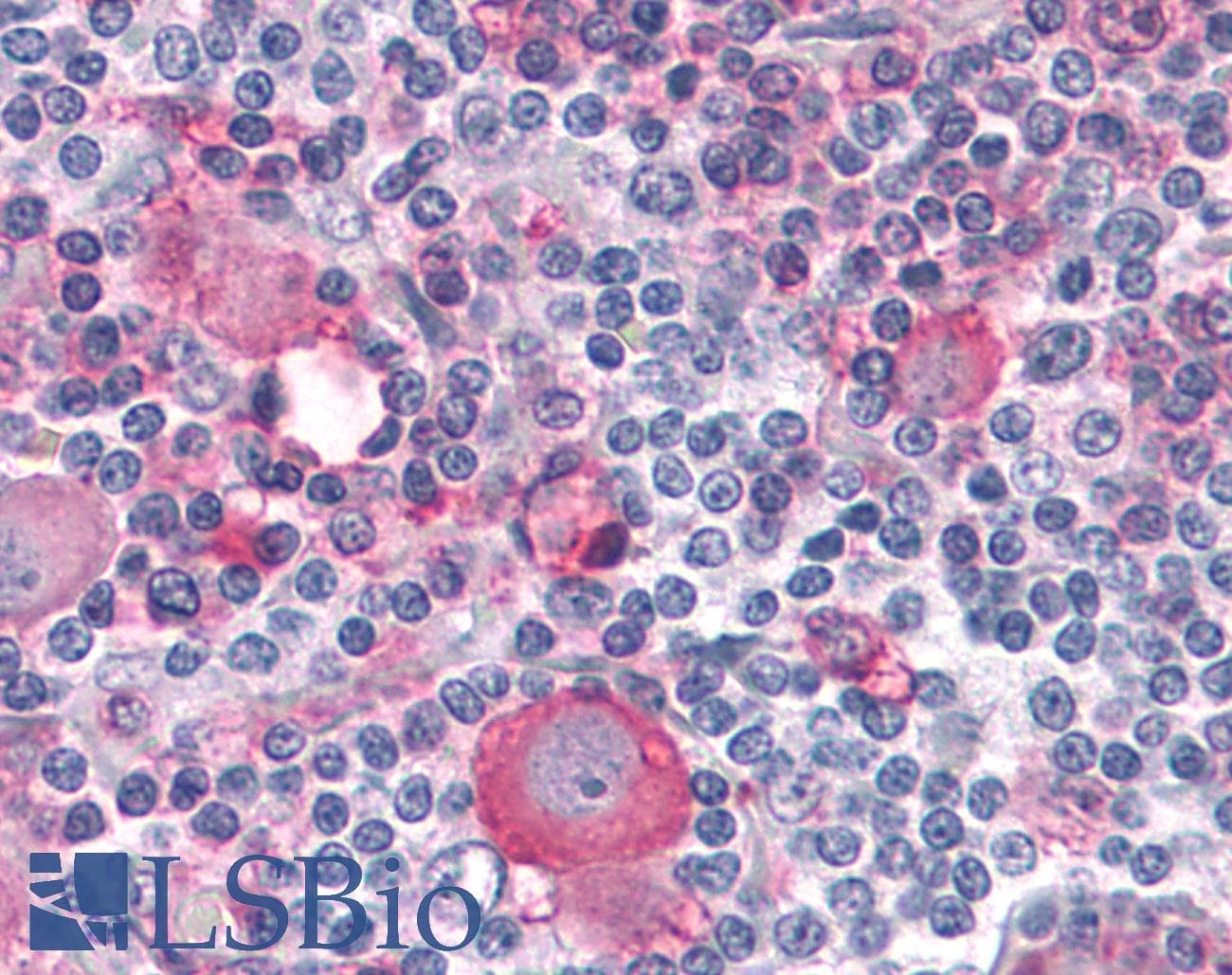 PathPlus™ PTPRA / RPTP-Alpha Antibody (Extracellular Domain)