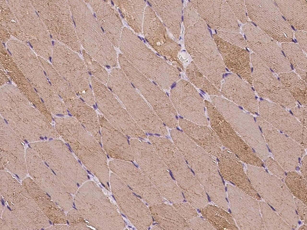 Polyclonal Rabbit anti-Human MASTL / GW Antibody (IHC)