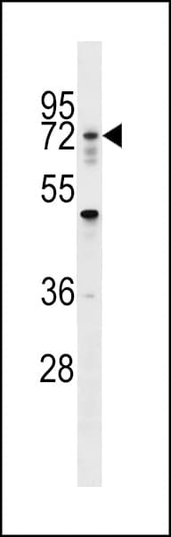 RNF112 / ZNF179 Antibody (aa1-30)