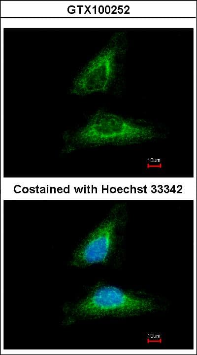 EML1 / EMAP Antibody (aa753-815)