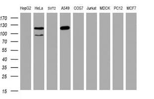 SF3A1 / SF3A120 Antibody (aa249-568, clone OTI3F4, Carrier-free)
