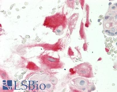 IHC-plus™ KIND2 / FERMT2 Antibody (clone 9E4)