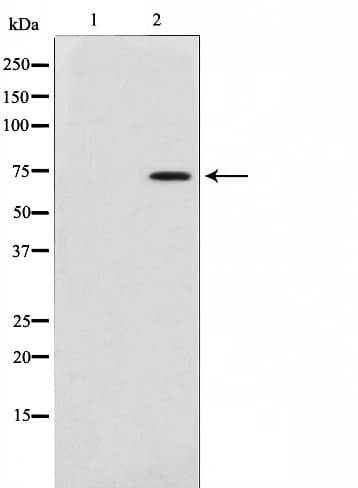 Polyclonal Rabbit anti-Human FOXO1 / FKHR Antibody (phospho-Ser256, IHC, IF, WB)