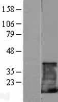 Human CD247 / CD3 Zeta Protein (Over-Expression Lysate Myc-DDK (Flag))