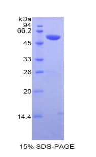 Mouse CASP14 / Caspase 14 Protein (Recombinant His-GST)