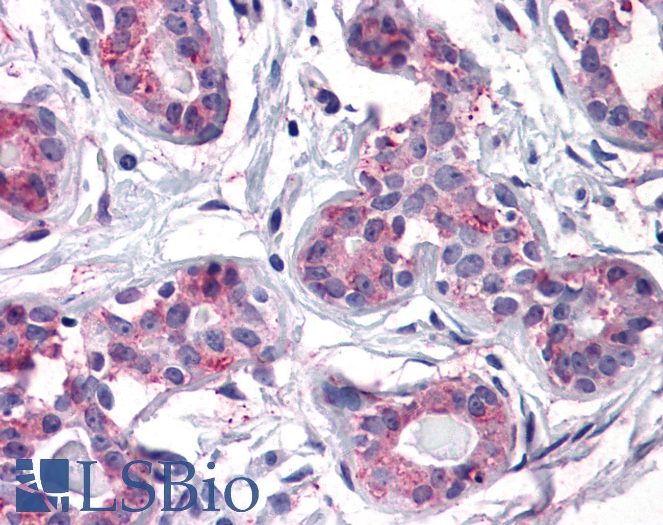 IHC-plus™ ENTPD2 Antibody (Internal)