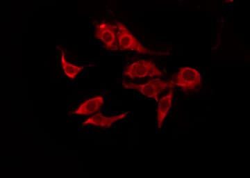 Polyclonal Rabbit anti-Human CSF2RB / CD131 Antibody (IF, WB)
