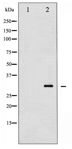 TNNI3 / Cardiac Troponin I Antibody (phospho-Thr142)