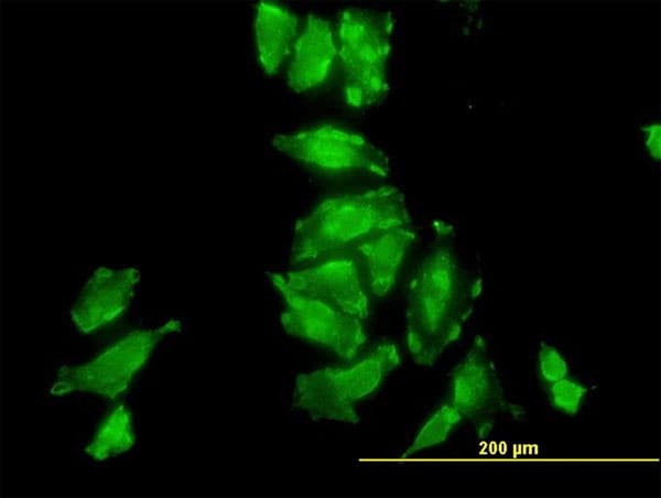 IHC-plus™ Monoclonal Mouse anti-Human PSMD10 / Gankyrin Antibody (clone 4B5, IHC, IF, WB)