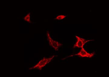 SPINK5 / LEKTI Antibody