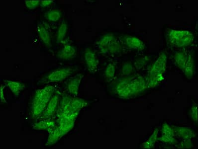 PHF21A / BHC80 Antibody