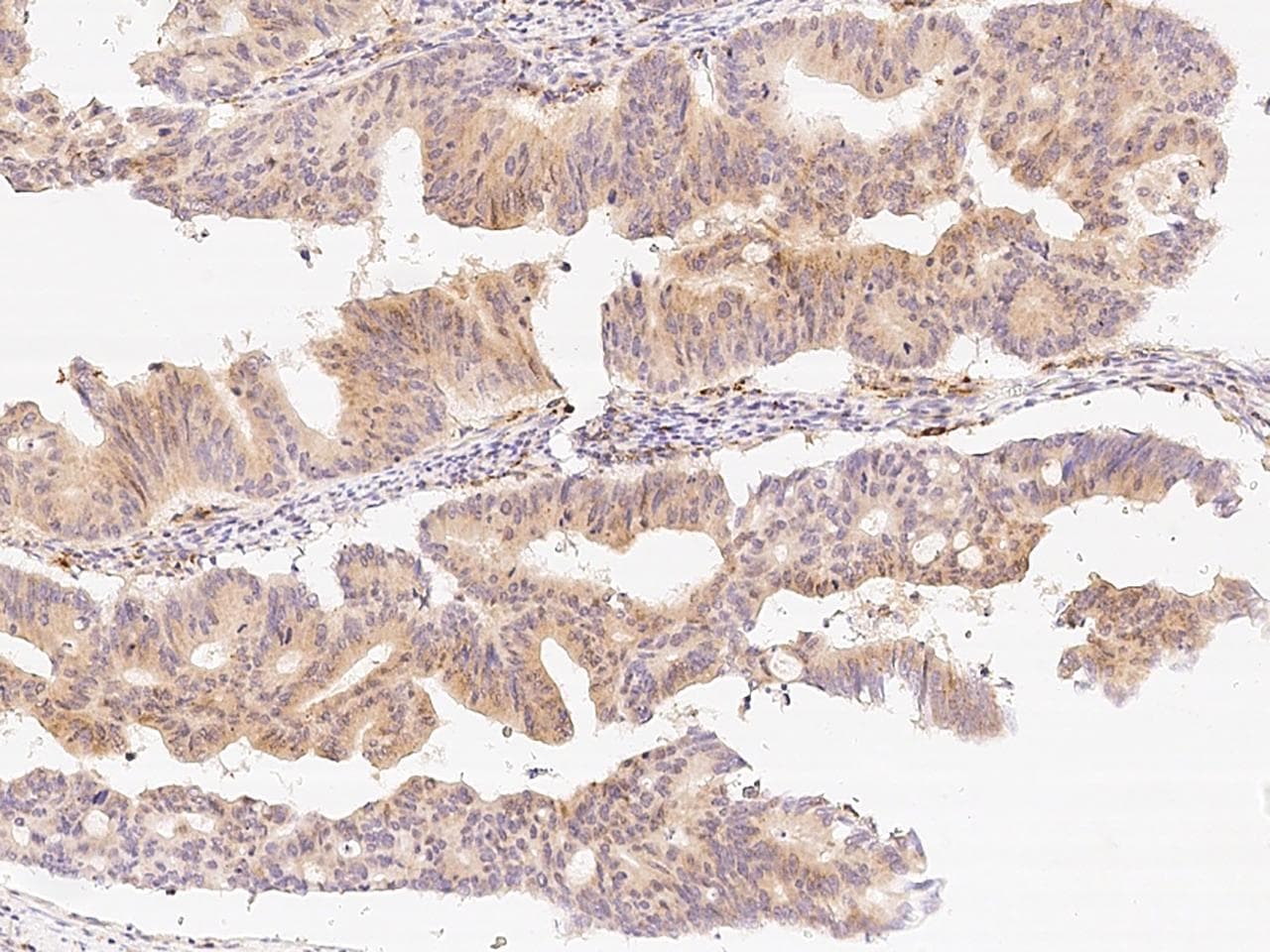 B3GNT2 Antibody (Preservative Free)