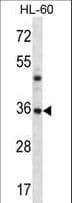 PSMB8 / LMP7 Antibody (aa8-36)