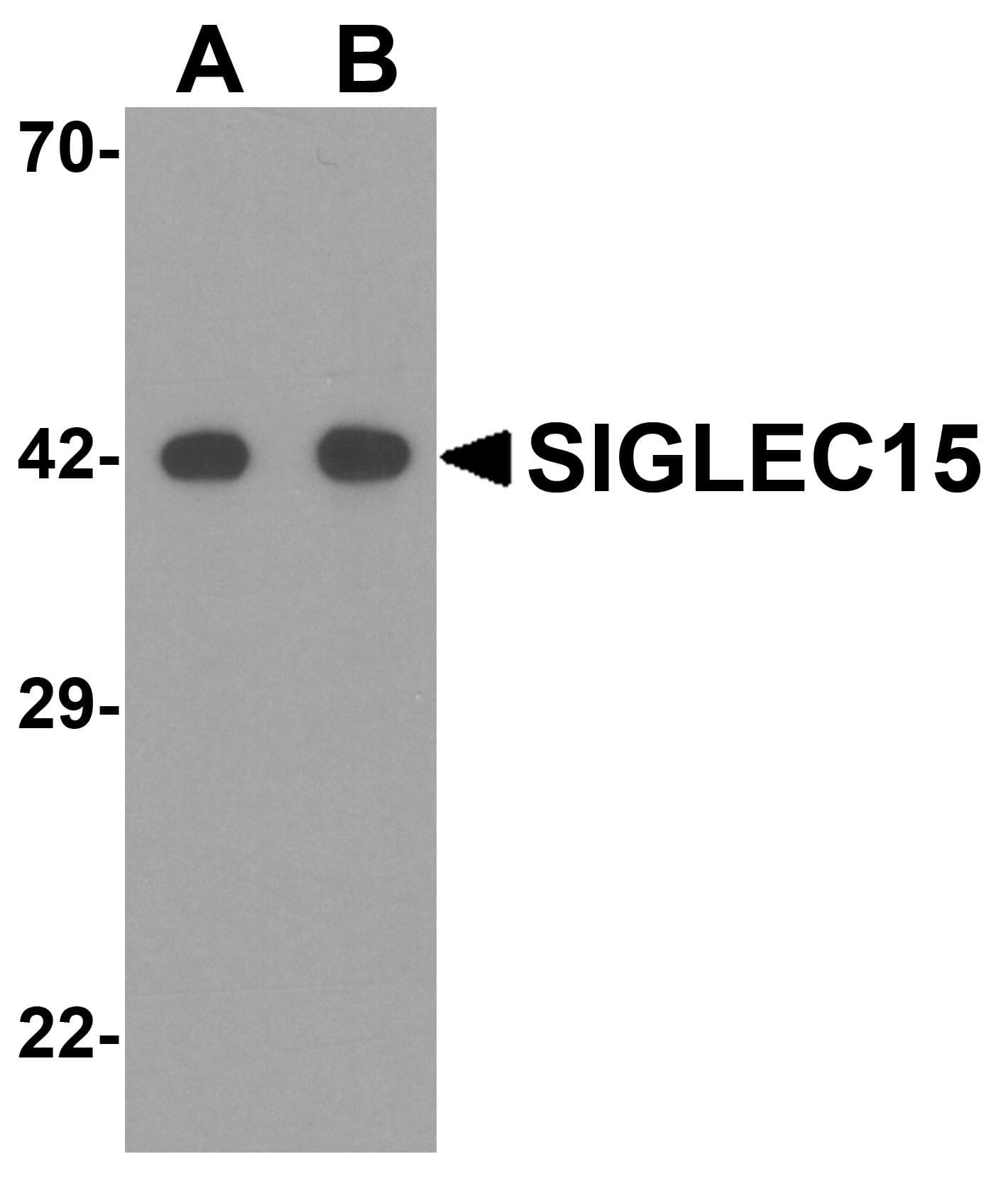 IHC-plus™ SIGLEC15 Antibody