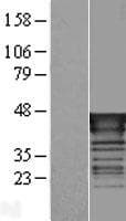 TAL1 Protein (Over-Expression Lysate Myc-DDK (Flag))