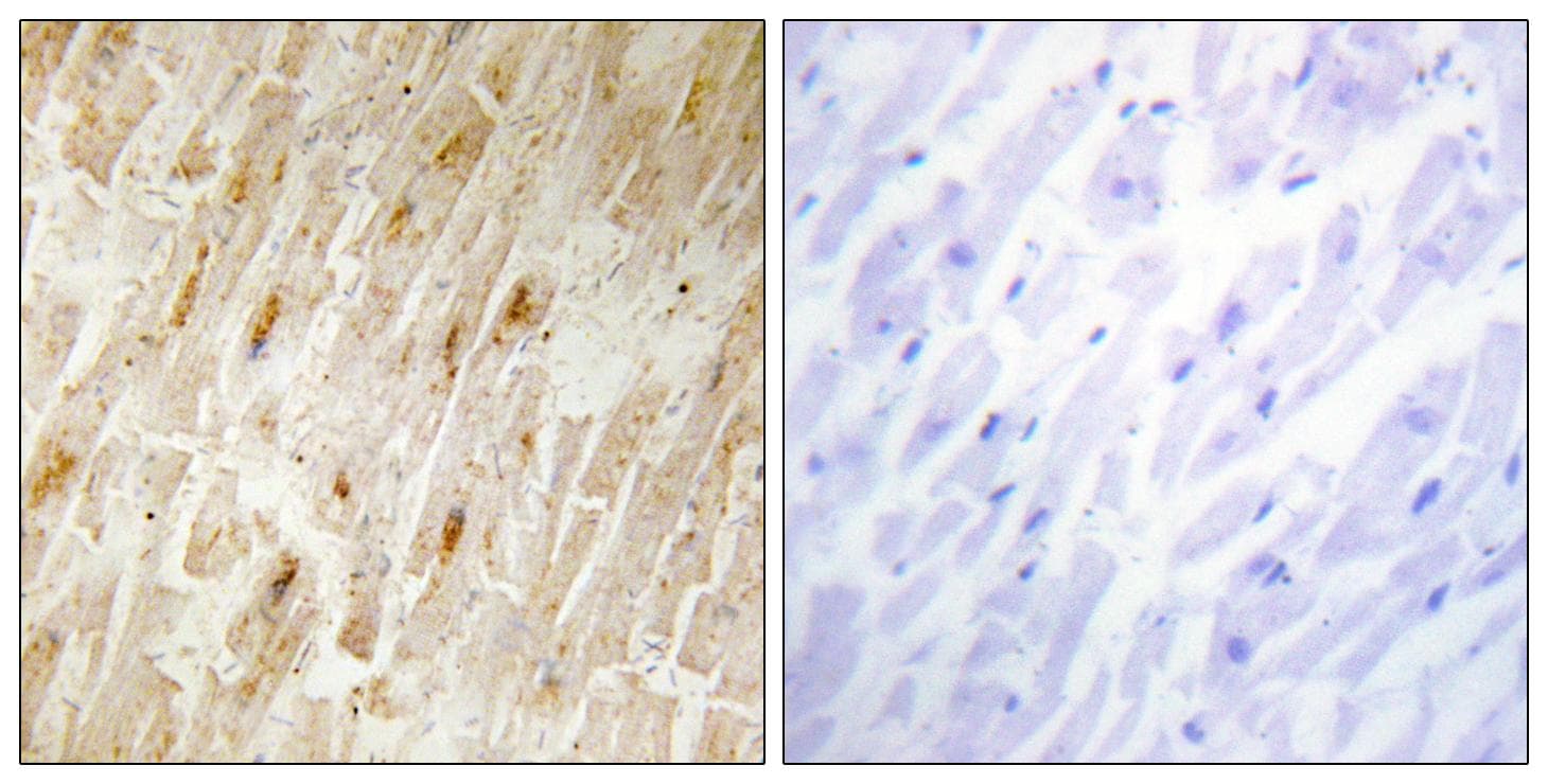 AKIP1 / BCA3 Antibody