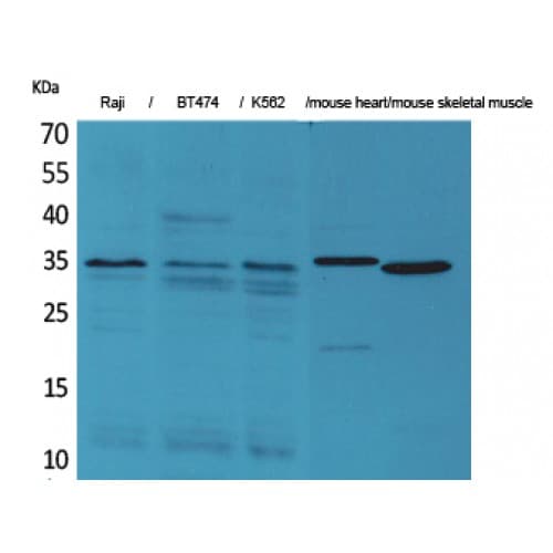 Polyclonal Rabbit anti-Human CLDN17 / Claudin 17 Antibody (150-230 aa, C-terminal, WB)
