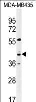 GPR45 Antibody (aa 121-149, Internal)