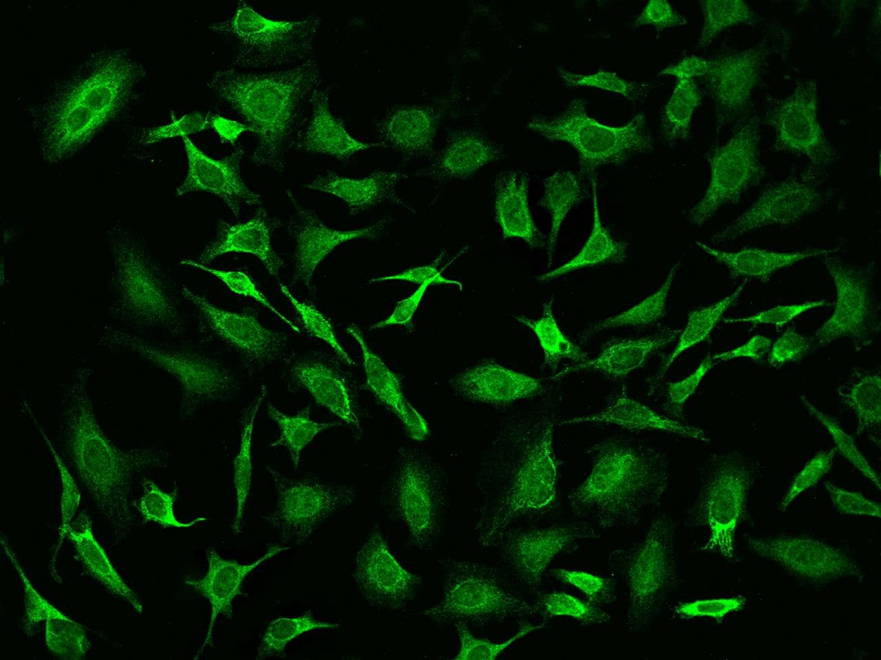PSPH Antibody (Preservative Free)