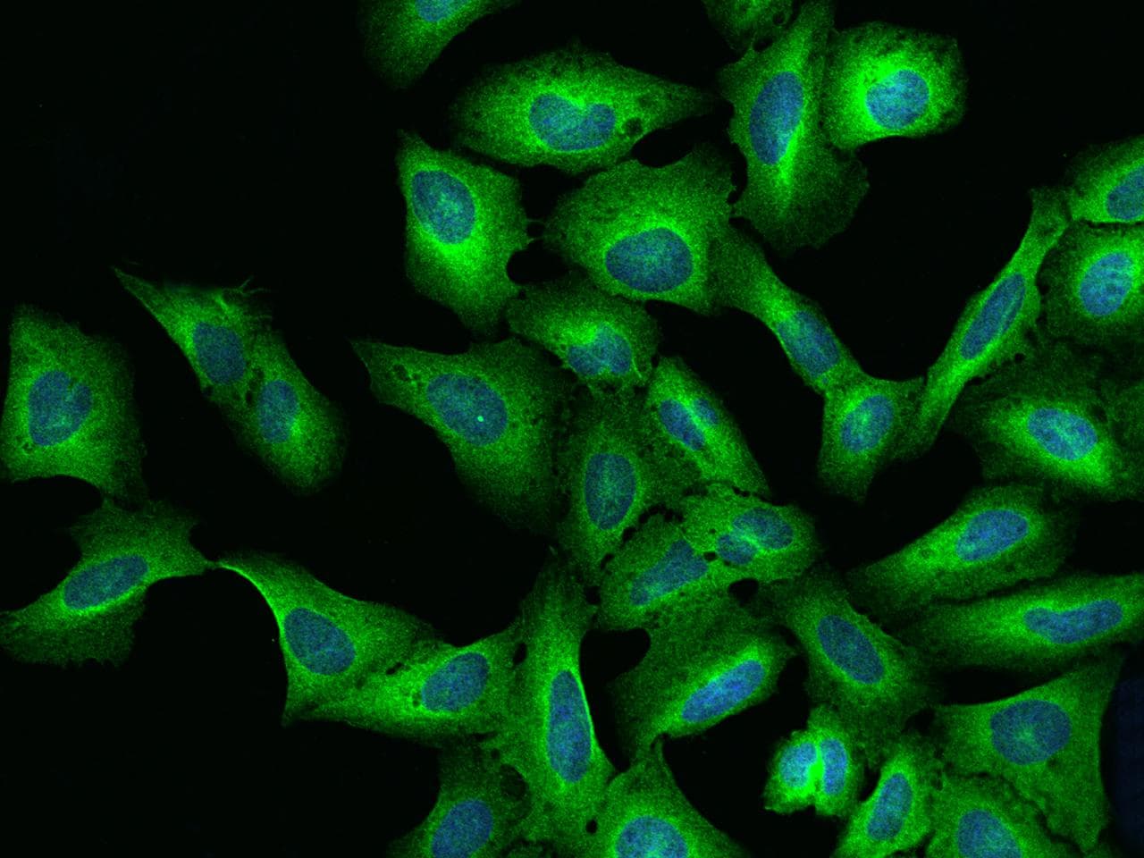 Polyclonal Rabbit anti-Human LRRC8B Antibody (IF)