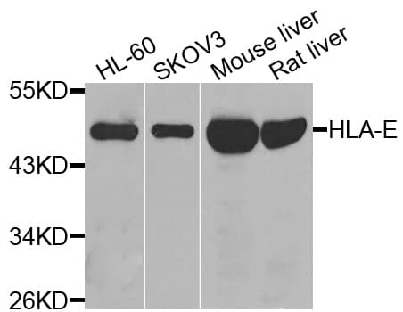 HLA-E Antibody