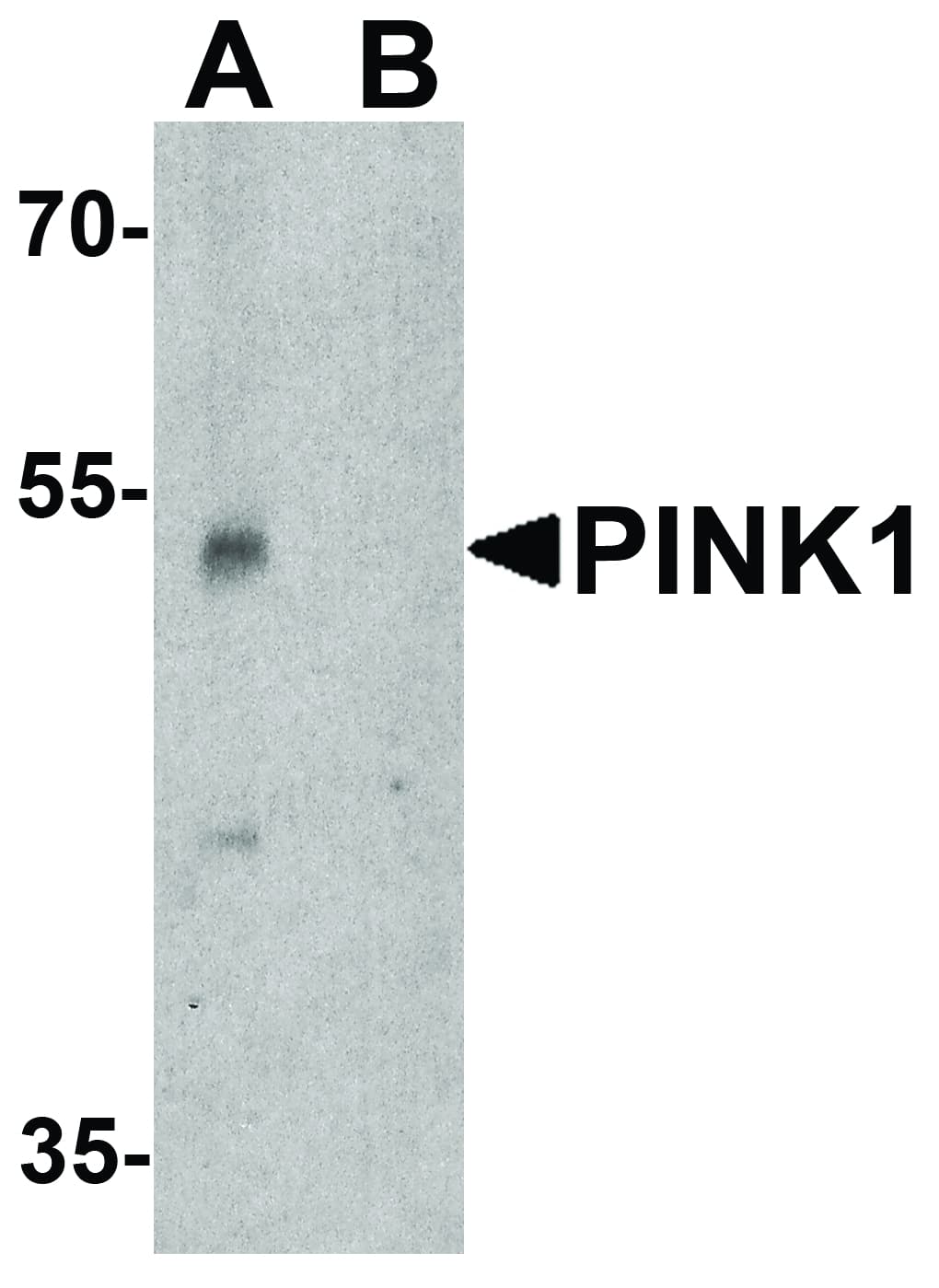 IHC-plus™ PINK1 Antibody