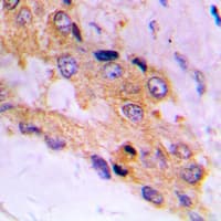 MTOR Antibody (phospho-S2448)